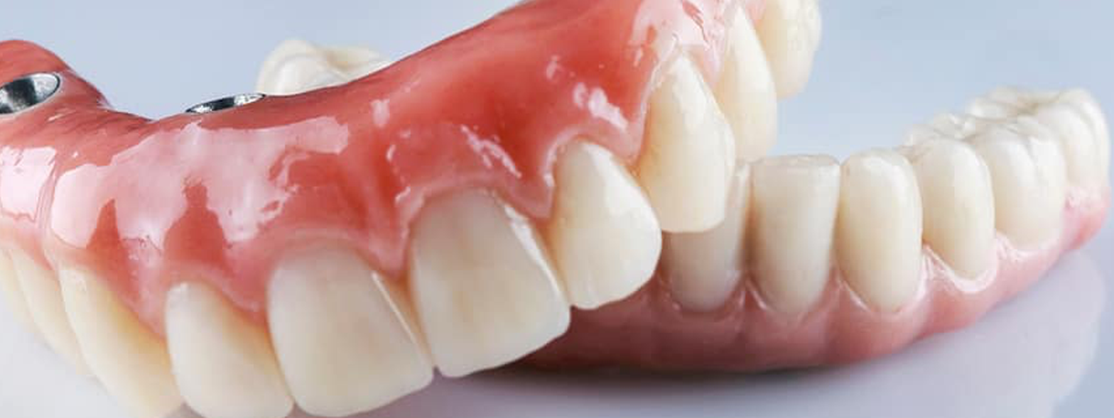 Compreendendo as Opções de Prótese Dentária: Fixas vs. Removíveis