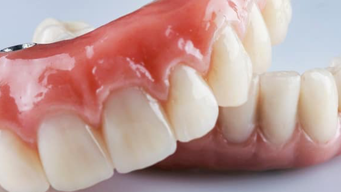 Compreendendo as Opções de Prótese Dentária: Fixas vs. Removíveis